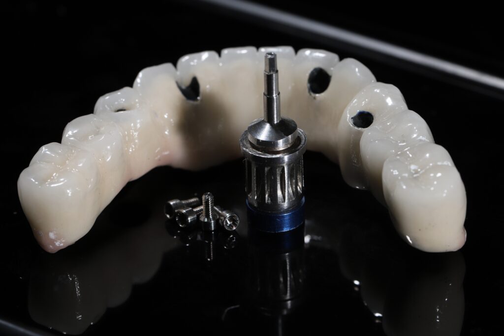 Dental Bridges phoenix